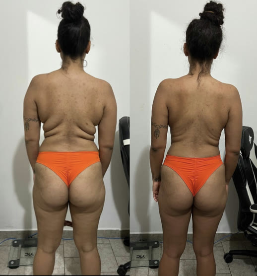 Aluna antes e depois do acompanhamento, vista de costas, com costas e cintura mais firmes
